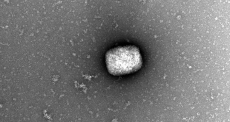 Partículas virales del virus del mono (monkeypox virus) observadas por microscopia electrónica de transmisión directamente del líquido obtenido de pústulas de pacientes infectados. Foto de EFE